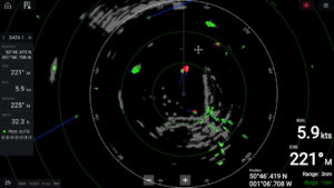 Dopplerradar
